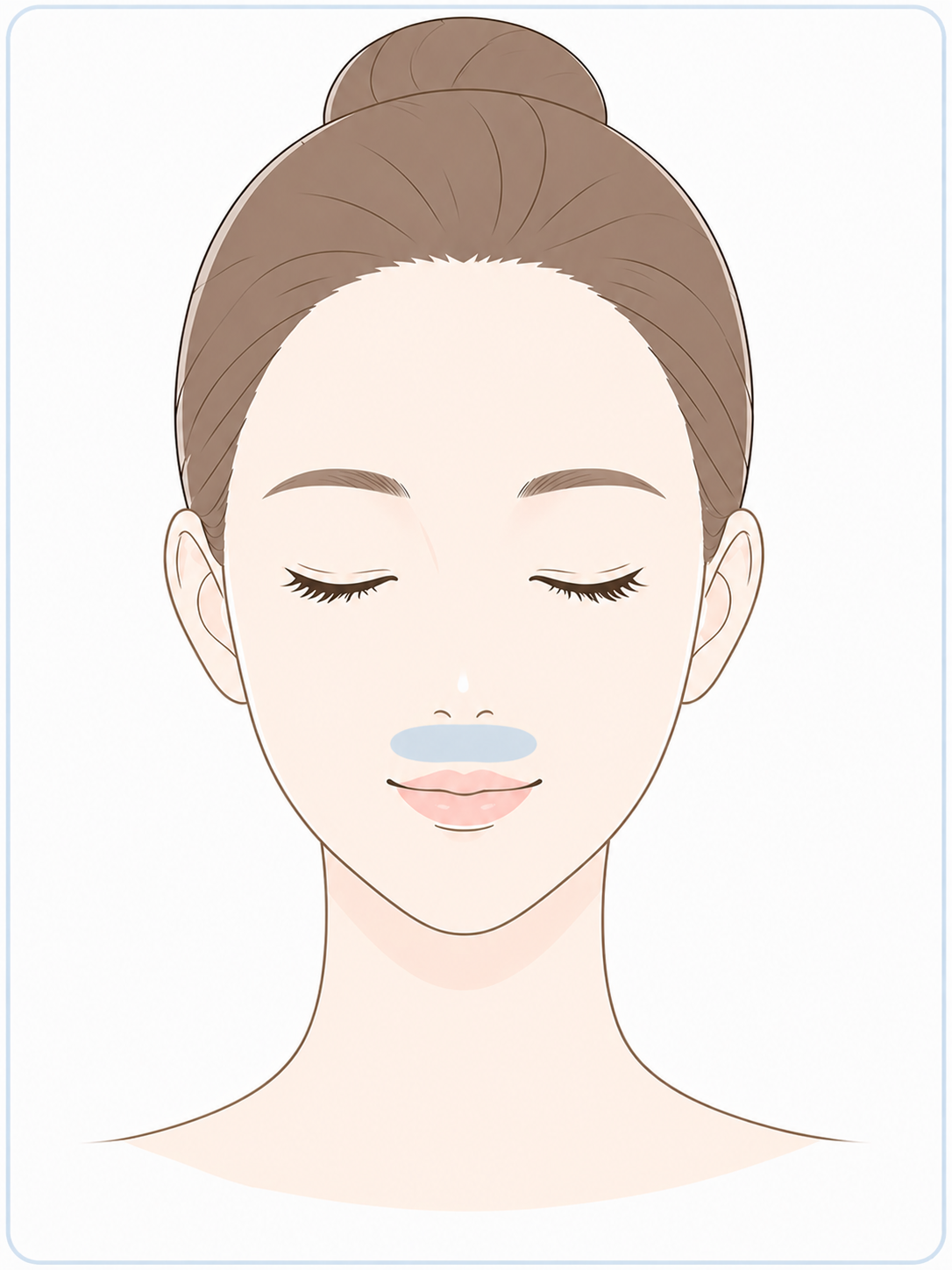 人中短縮ボトックス（リップフリップ）の施術部位イラスト